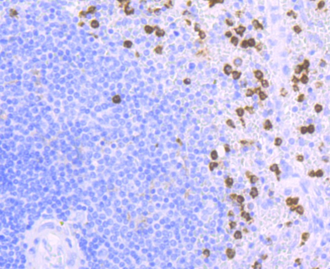 Anti-CD11b Antibody (5B108)