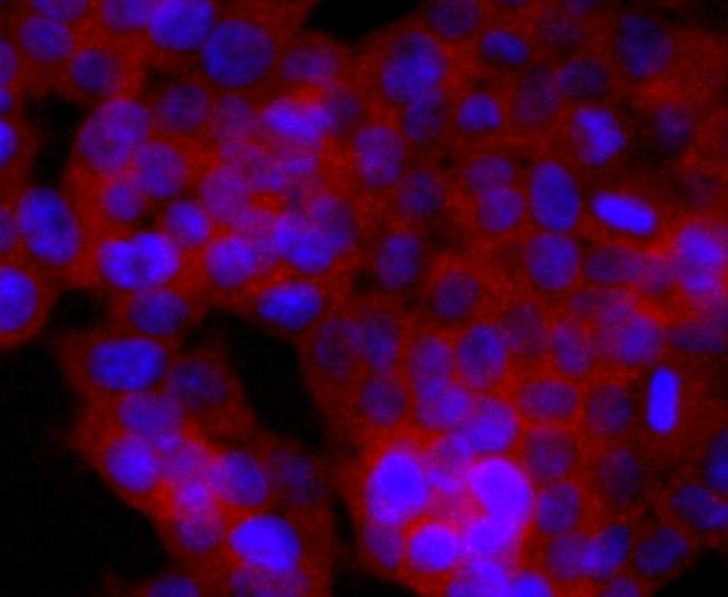 Anti-CD74 Antibody (9A482)