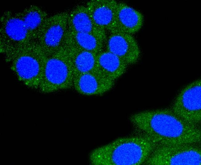 Anti-ITGAL Antibody (1J385)