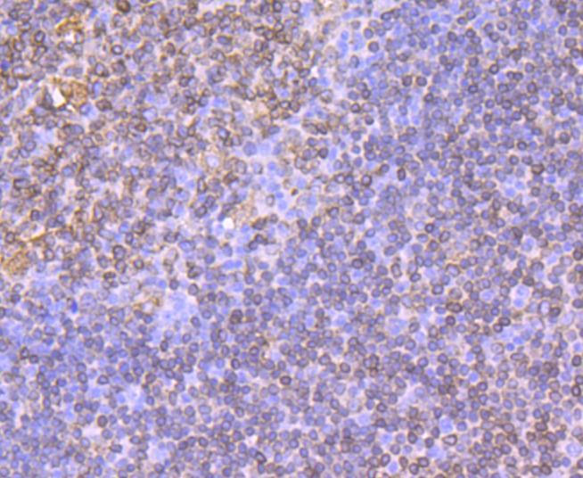 Anti-CD74 Antibody (9A482)