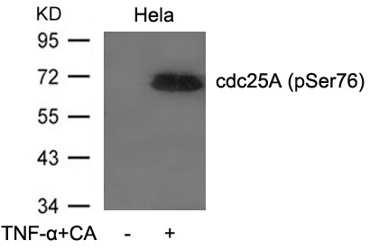Anti-Phospho-CDC25A (Ser76) Polyclonal Antibody