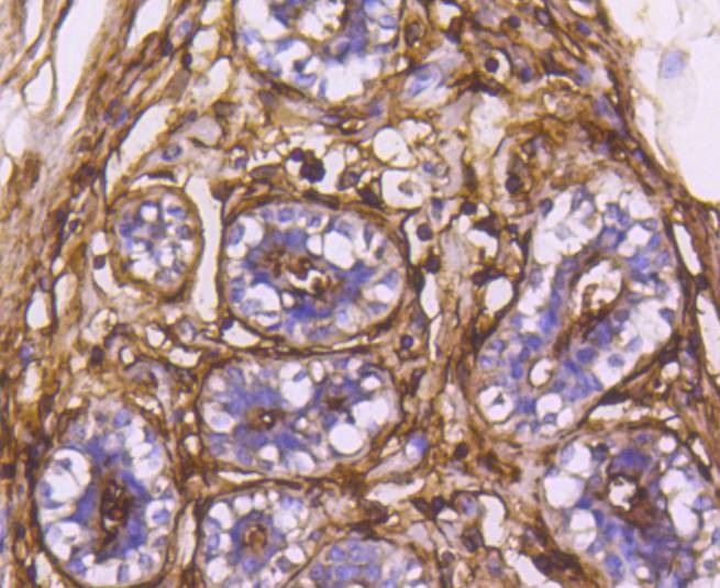 Anti-Aminopeptidase N/CD13 Antibody (3U499)