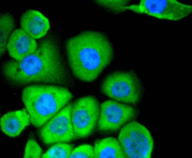 Anti-Aminopeptidase N/CD13 Antibody (3U499)