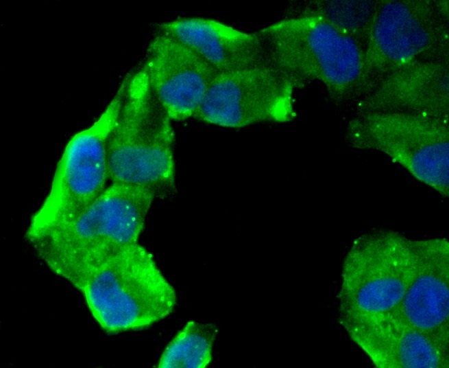 Anti-Aminopeptidase N/CD13 Antibody (3J107)