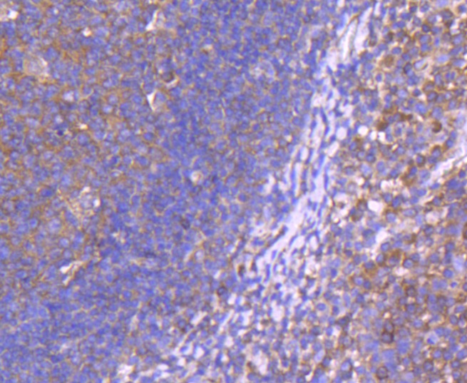Anti-Neprilysin/CD10 Antibody (5M454)
