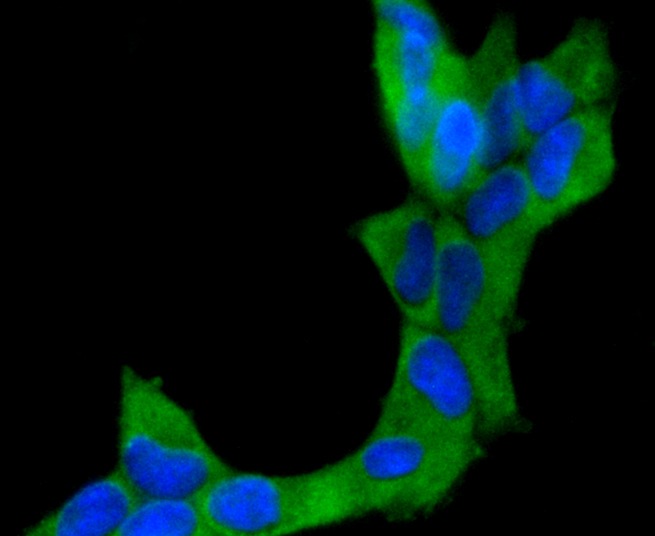 Anti-Neprilysin/CD10 Antibody (5M454)