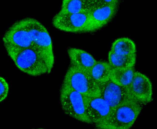 Anti-CDC34 Antibody (7P182)