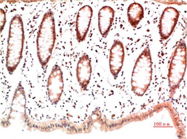 Anti-Collagen I Antibody (5V402)