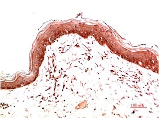 Anti-Collagen I Antibody (4T545)