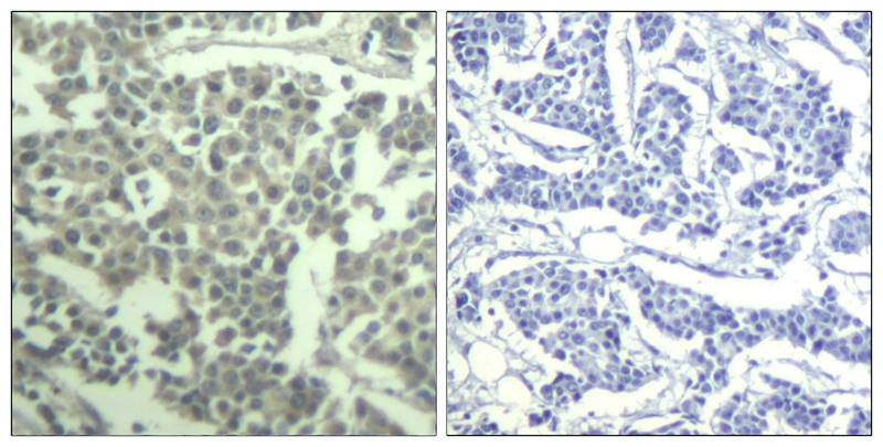 Anti-Phospho-CD117 (Tyr936) Polyclonal Antibody