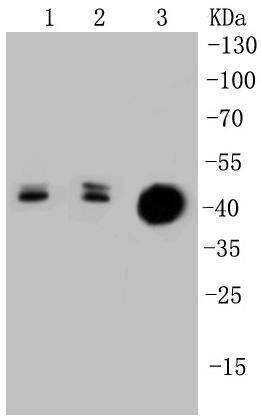 Anti-KRT20 Antibody (7P648)