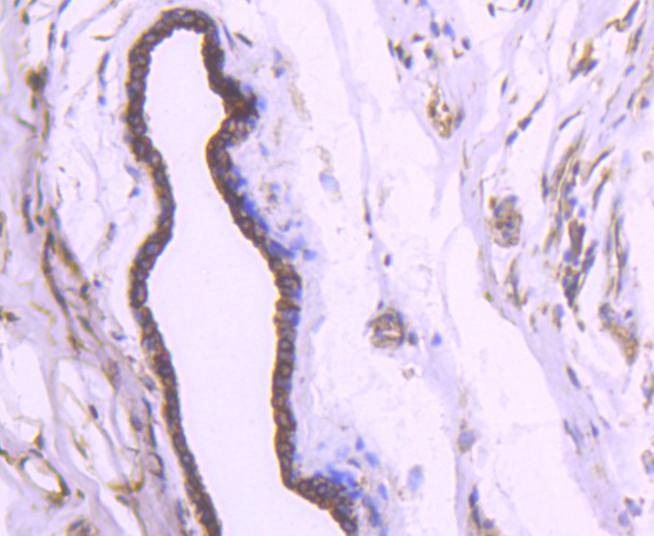Anti-KRT18 Antibody (5J111)