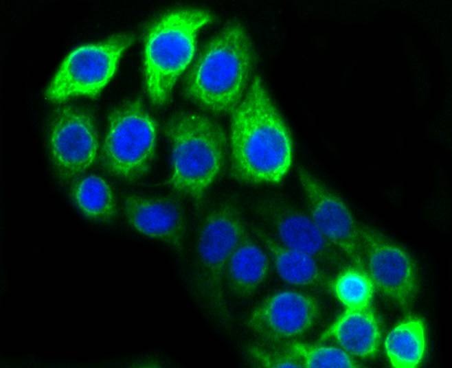 Anti-KRT20 Antibody (7P648)
