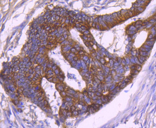 Anti-KRT18 Antibody (5J111)