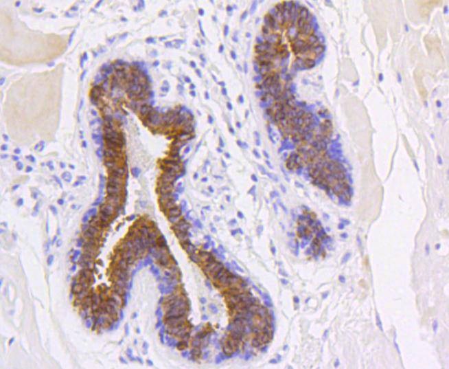 Anti-KRT19 Antibody (4B372)