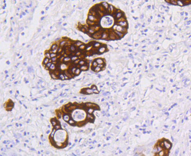 Anti-KRT19 Antibody (4B372)