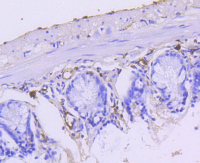 Anti-KRT15 Antibody (3G540)