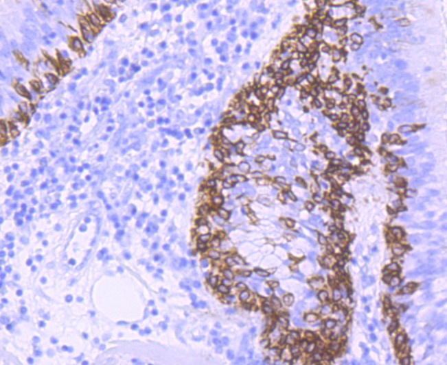 Anti-KRT5 Antibody (1O482)