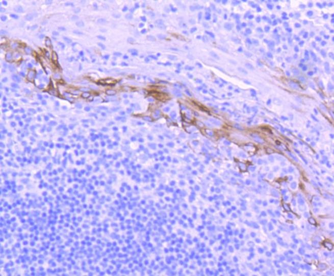 Anti-KRT10 Antibody (5Q202)
