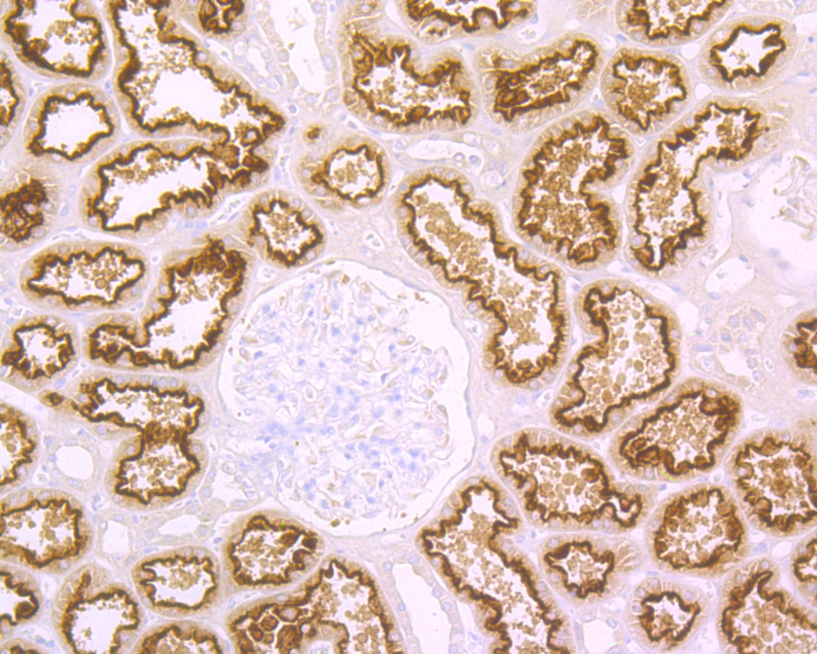 Anti-Cubilin Antibody (8J369)