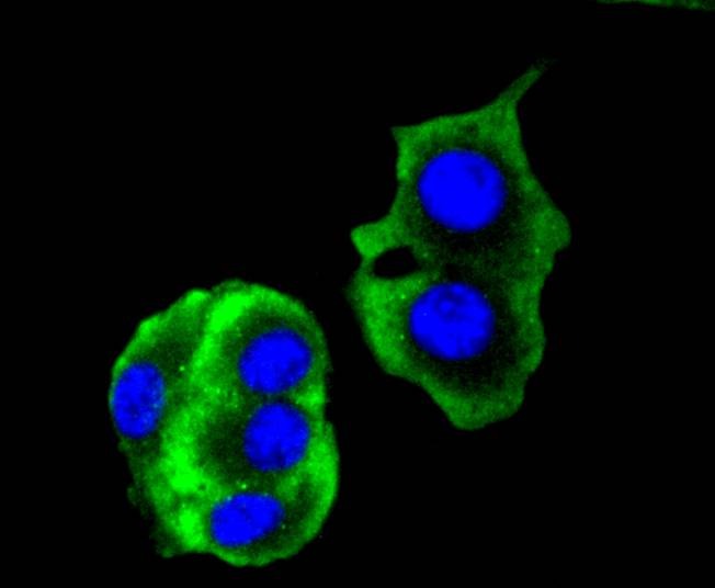 Anti-KRT14 Antibody (3K758)