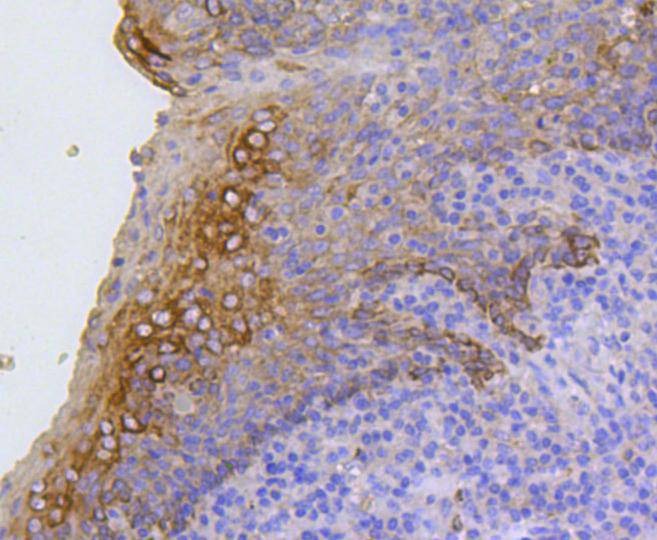 Anti-KRT17 Antibody (9X387)