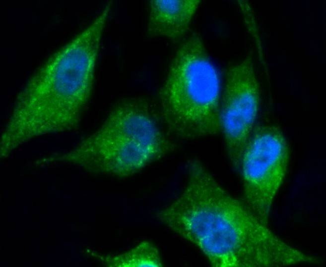 Anti-KRT17 Antibody (9X387)
