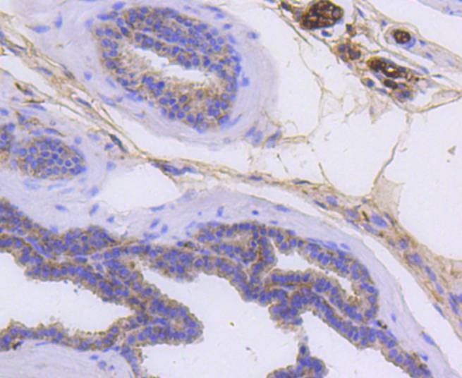 Anti-KRT14 Antibody (3K758)