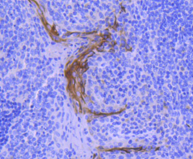 Anti-KRT4 Antibody (5F548)
