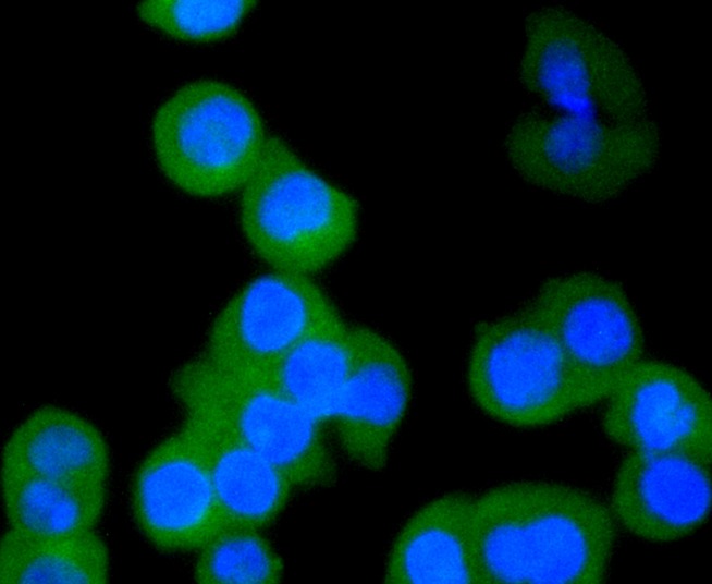 Anti-KRT4 Antibody (5F548)
