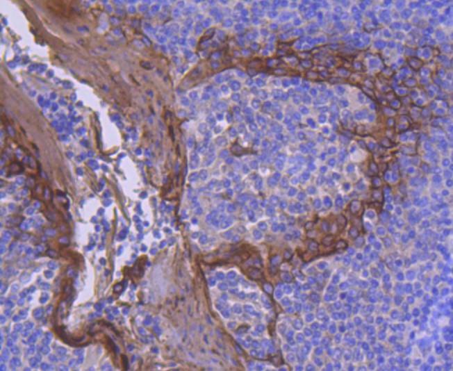 Anti-KRT2 Antibody (6L268)