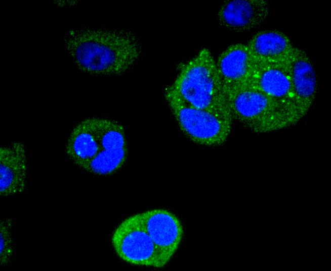 Anti-KRT4 Antibody (8Y508)