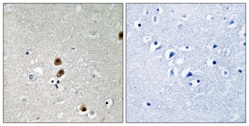 Anti-Phospho-CtBP1 (Ser422) Polyclonal Antibody