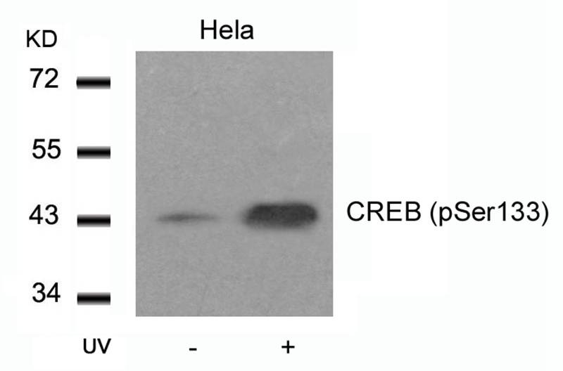 Anti-Phospho-CREB1 (Ser133) Polyclonal Antibody 2