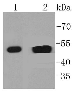 Anti-KRT14 Antibody (3K758)