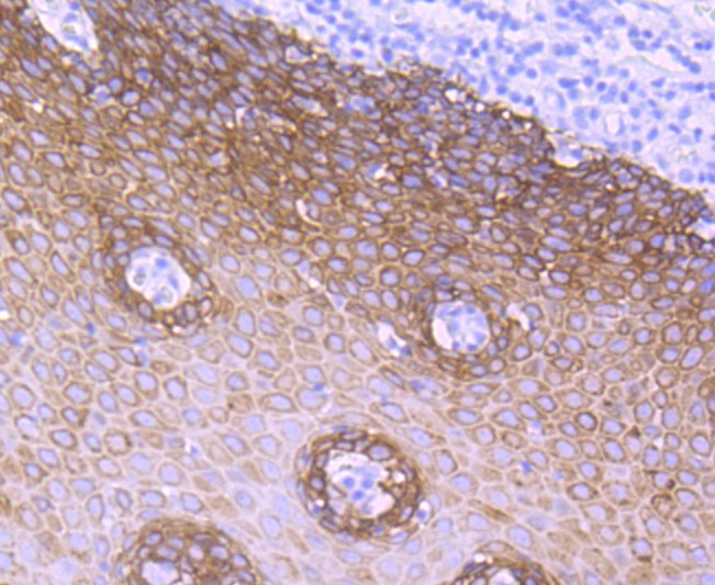 Anti-KRT5 Antibody (1O482)