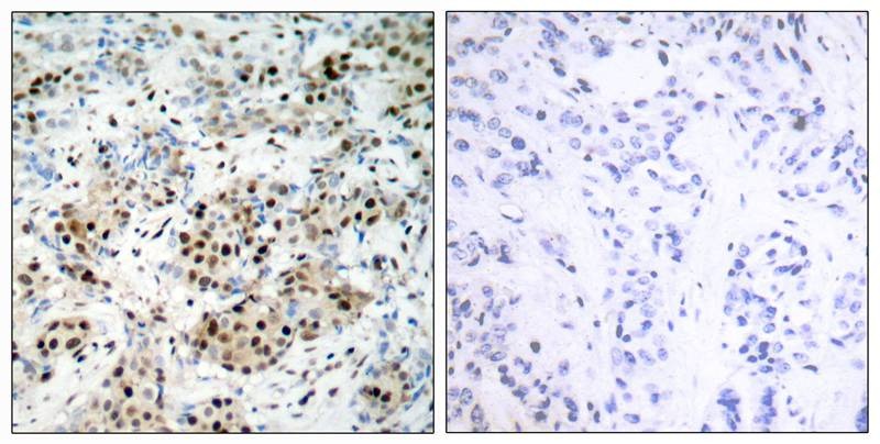 Anti-Phospho-CREB1 (Ser133) Polyclonal Antibody 2
