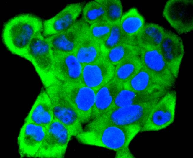 Anti-KRT18 Antibody (5J111)
