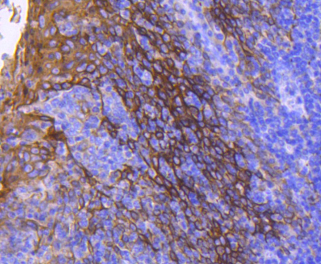 Anti-KRT13 Antibody (2C427)