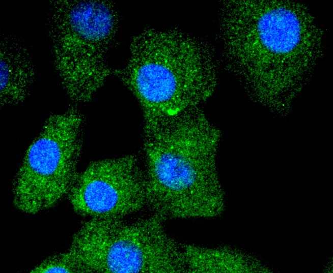 Anti-KRT13 Antibody (2C427)