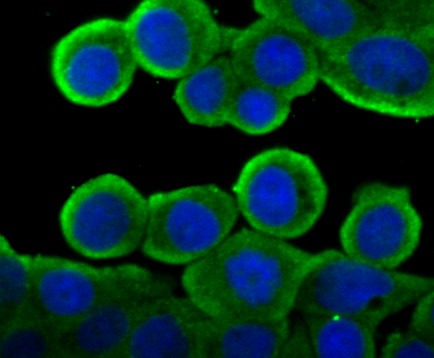 Anti-CYPOR Antibody (2K509)