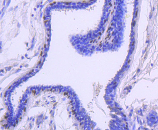 Anti-KRT13 Antibody (2C427)
