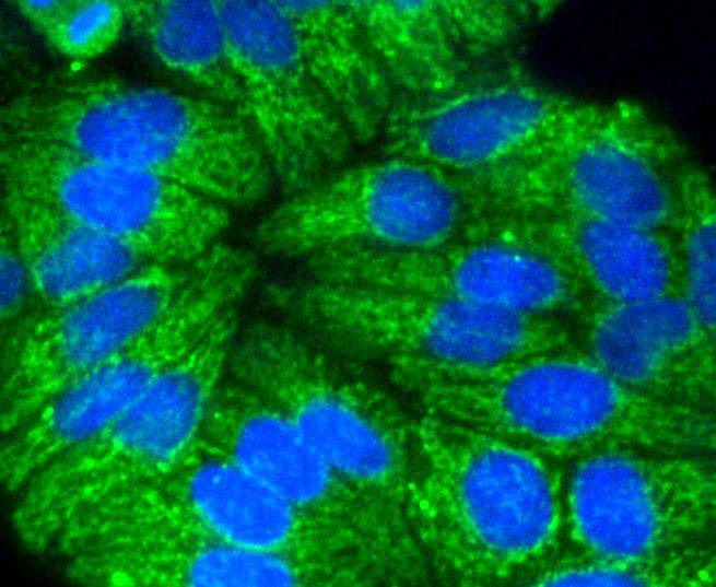Anti-KRT17 Antibody (9X387)