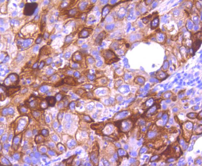 Anti-KRT16 Antibody (3O311)