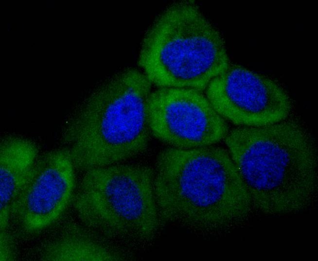 Anti-KRT16 Antibody (3O311)