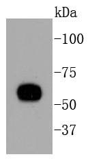 Anti-KRT10 Antibody (5Q202)