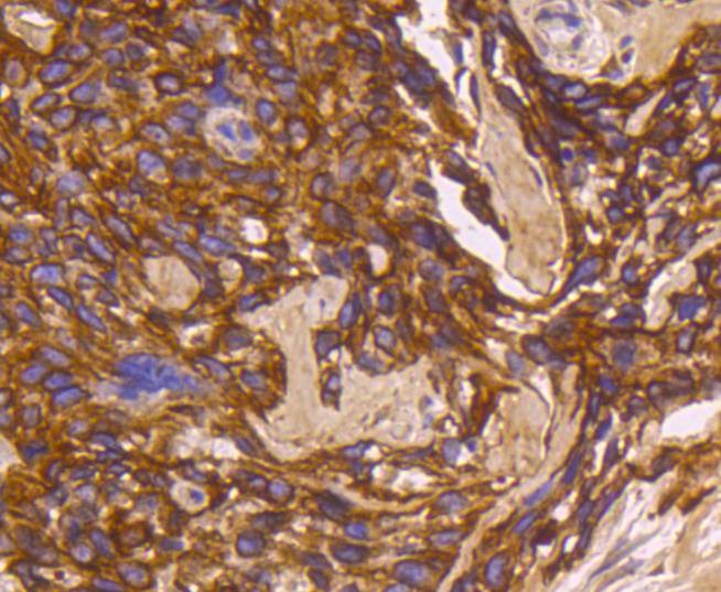 Anti-KRT16 Antibody (3O311)