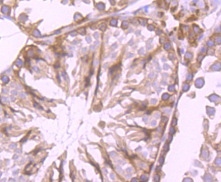 Anti-CYPOR Antibody (2K509)