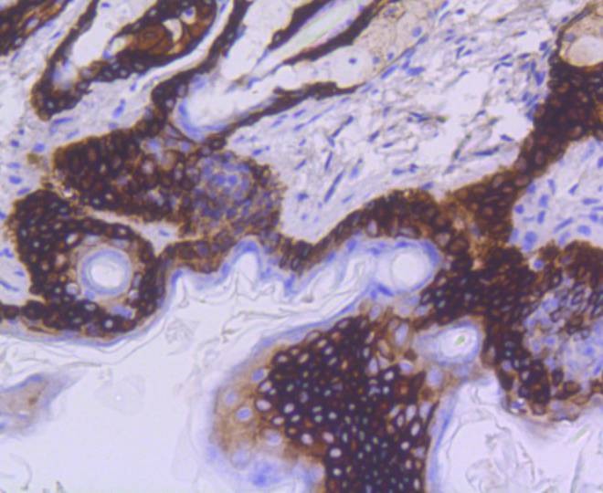 Anti-KRT15 Antibody (3G540)
