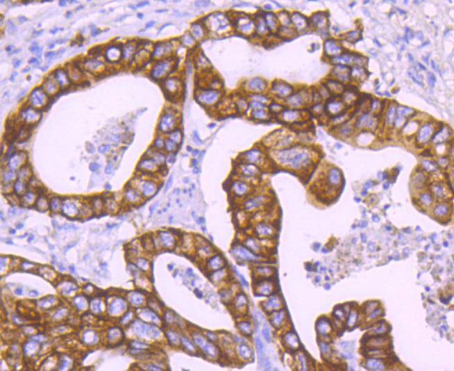 Anti-KRT18 Antibody (5J111)